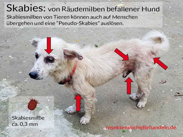 Mittel gegen Krätze, Scabies, Krätze Milben beim Menschen bekämpfen